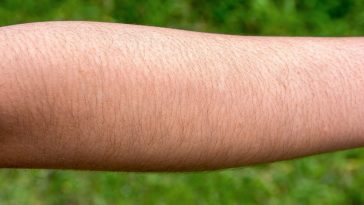 guy obsessed with hairy arms