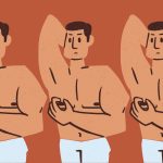male nipple surgery